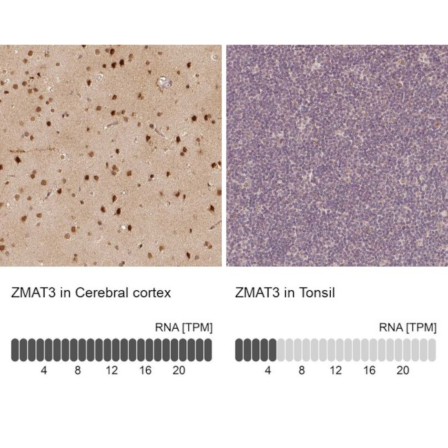 ZMAT3 Antibody