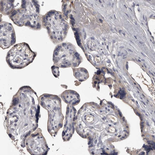 ALDH5A1 Antibody in Immunohistochemistry (Paraffin) (IHC (P))