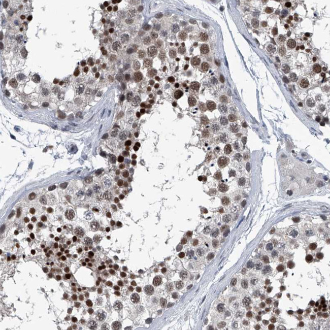 Menin Antibody in Immunohistochemistry (Paraffin) (IHC (P))