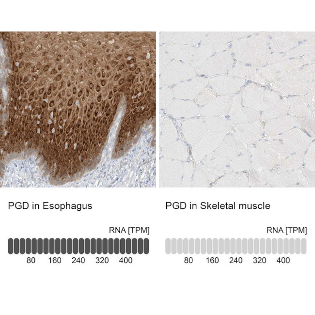 PGD Antibody