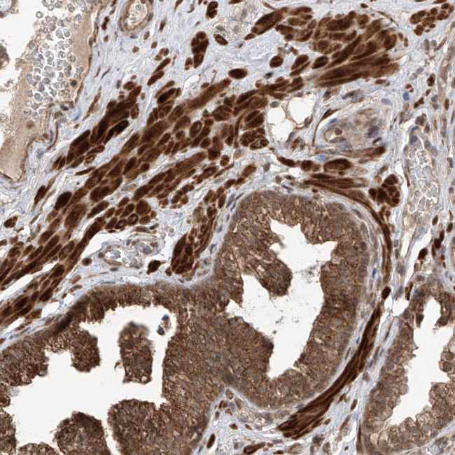 LATS1 Antibody in Immunohistochemistry (Paraffin) (IHC (P))