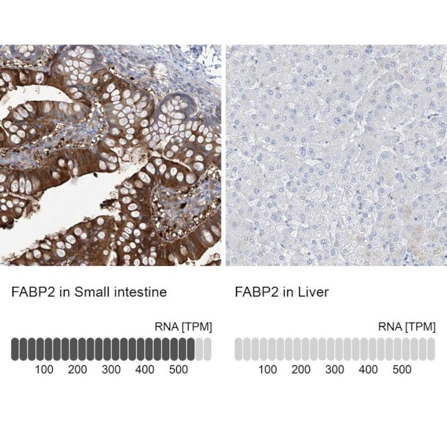 FABP2 Antibody