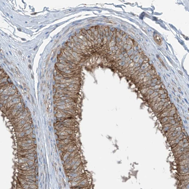 ASCT2 Antibody in Immunohistochemistry (Paraffin) (IHC (P))