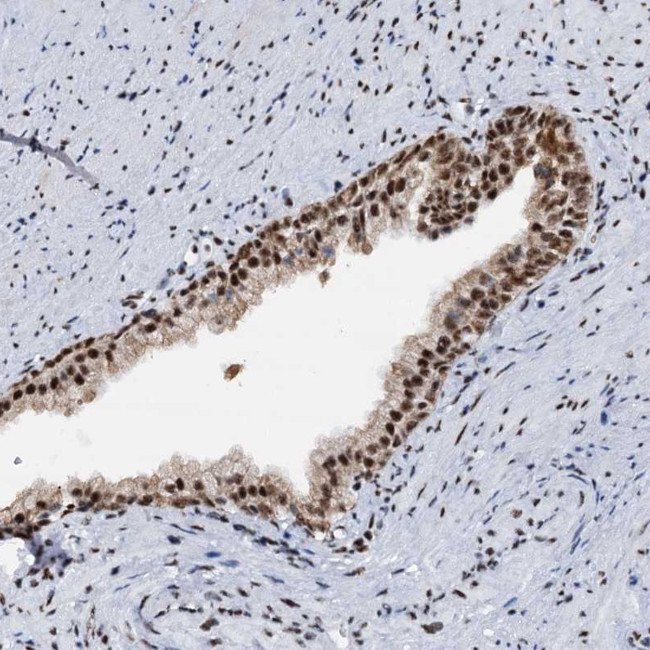 DDX23 Antibody in Immunohistochemistry (Paraffin) (IHC (P))