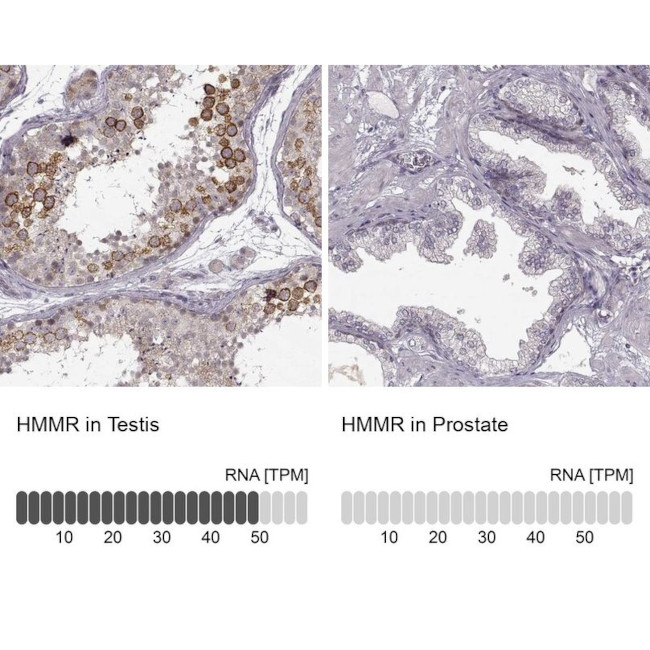 RHAMM Antibody