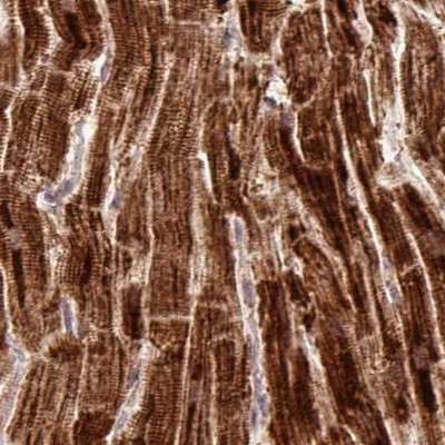 ATP5A1 Antibody in Immunohistochemistry (Paraffin) (IHC (P))