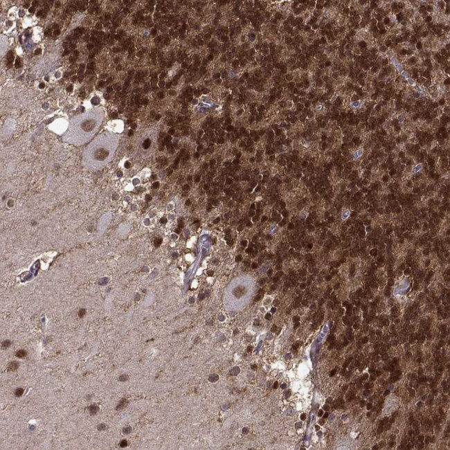 FTO Antibody in Immunohistochemistry (Paraffin) (IHC (P))