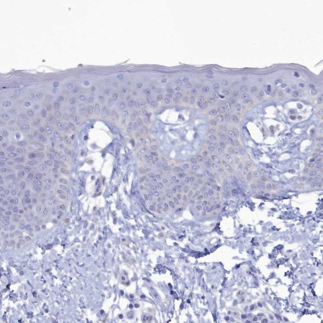 CPI-17 Antibody in Immunohistochemistry (Paraffin) (IHC (P))