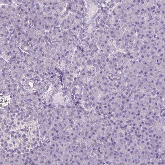 COL7A1 Antibody in Immunohistochemistry (Paraffin) (IHC (P))