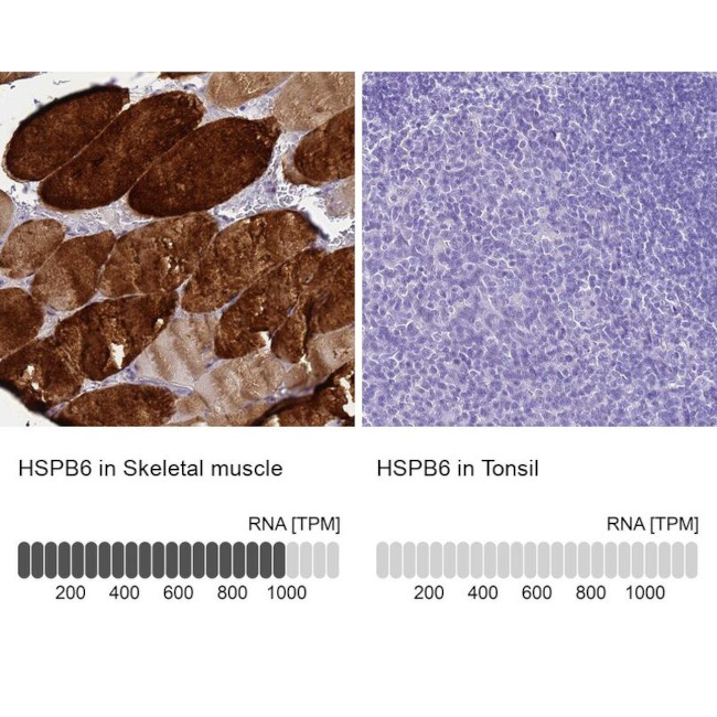 HSP20 Antibody