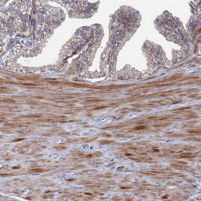 GTF2IRD1 Antibody in Immunohistochemistry (Paraffin) (IHC (P))