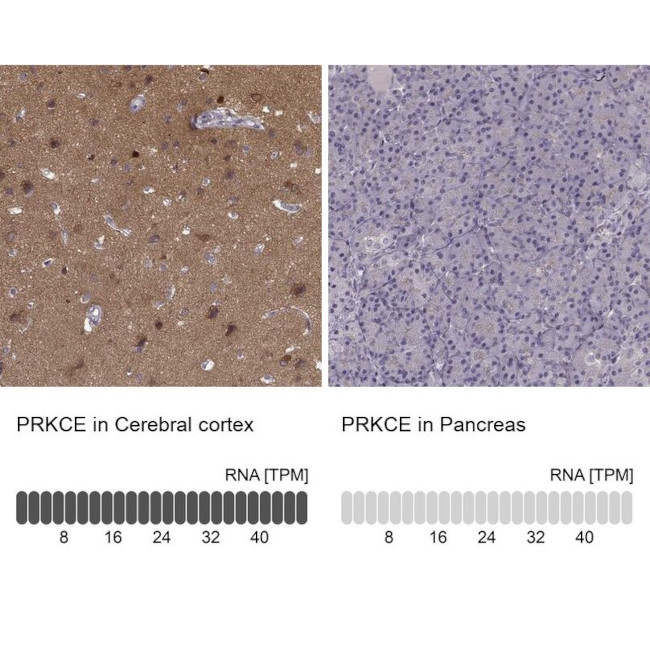 PKC epsilon Antibody