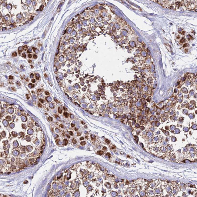 DLD Antibody in Immunohistochemistry (Paraffin) (IHC (P))