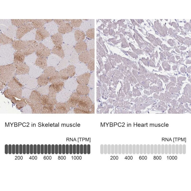 MYBPC2 Antibody