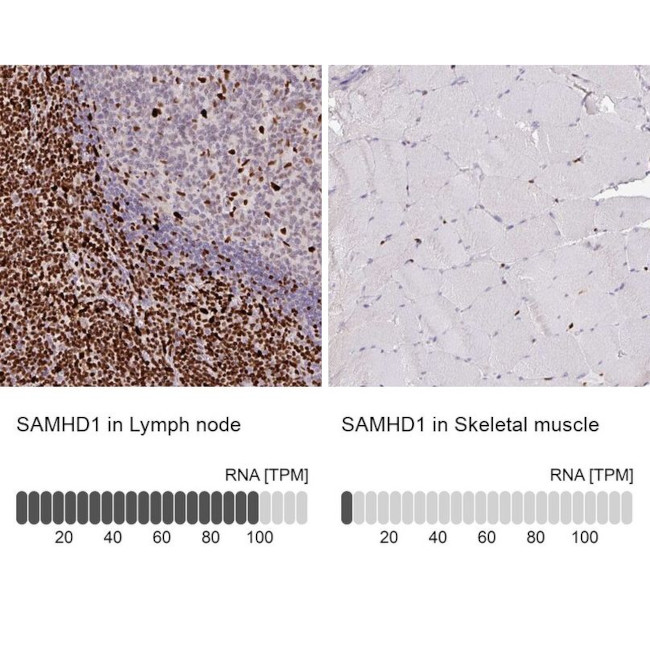 SAMHD1 Antibody