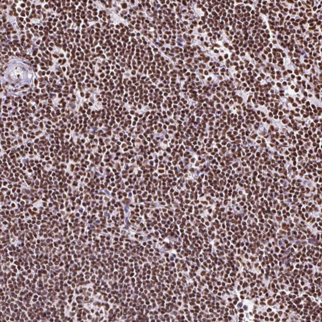 Ku70 Antibody in Immunohistochemistry (Paraffin) (IHC (P))