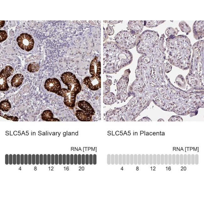 SLC5A5 Antibody