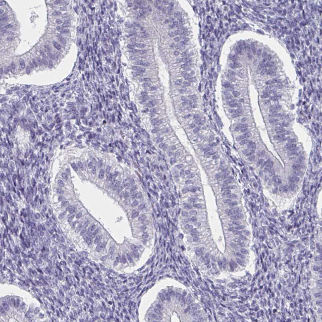 FOXA1 Antibody in Immunohistochemistry (Paraffin) (IHC (P))