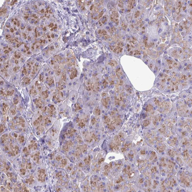 Clathrin Light Chain A Antibody in Immunohistochemistry (Paraffin) (IHC (P))