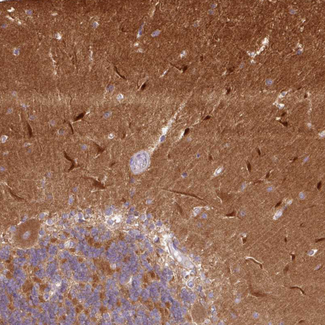 CaMKII alpha Antibody in Immunohistochemistry (Paraffin) (IHC (P))