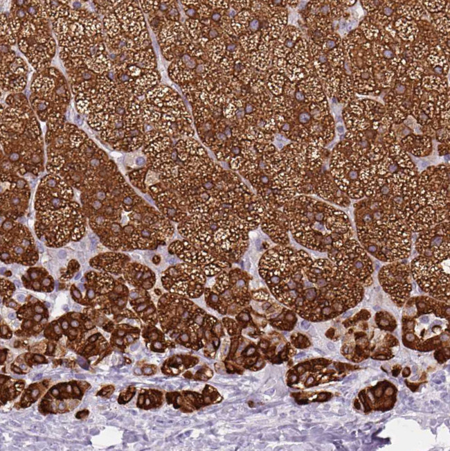 CYP21A2 Antibody in Immunohistochemistry (Paraffin) (IHC (P))