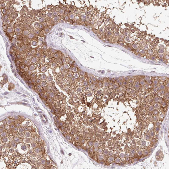 HFE Antibody in Immunohistochemistry (Paraffin) (IHC (P))