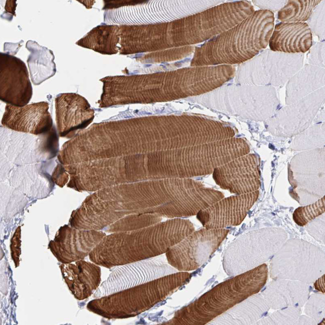 Cardiac Troponin C Antibody in Immunohistochemistry (Paraffin) (IHC (P))