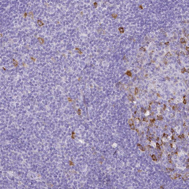 Cyclin B1 Antibody in Immunohistochemistry (Paraffin) (IHC (P))