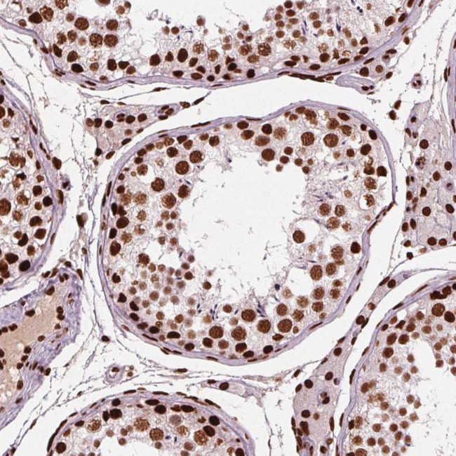 BRD4 Antibody in Immunohistochemistry (Paraffin) (IHC (P))