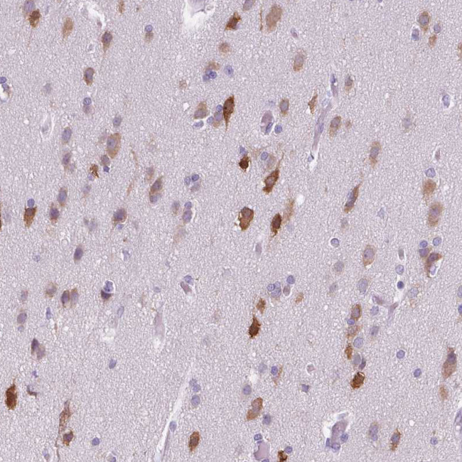 ELAVL2 Antibody in Immunohistochemistry (Paraffin) (IHC (P))