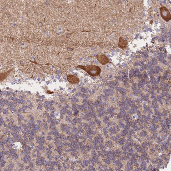 HS3ST5 Antibody in Immunohistochemistry (Paraffin) (IHC (P))