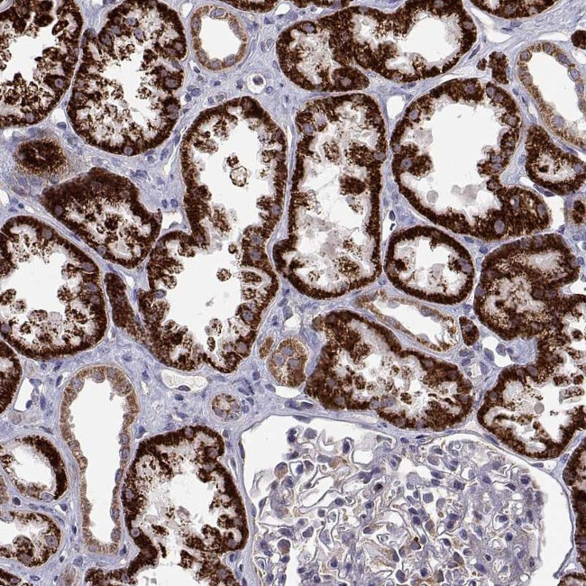 DHTKD1 Antibody in Immunohistochemistry (Paraffin) (IHC (P))