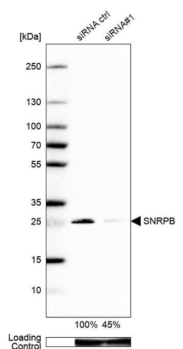 SNRPB Antibody