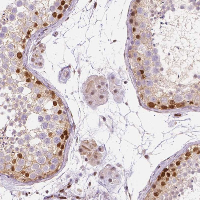 ERF Antibody in Immunohistochemistry (Paraffin) (IHC (P))