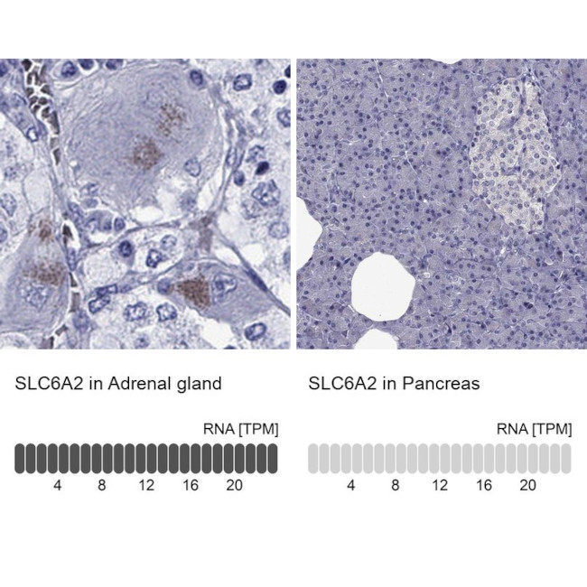 Norepinephrine Transporter Antibody