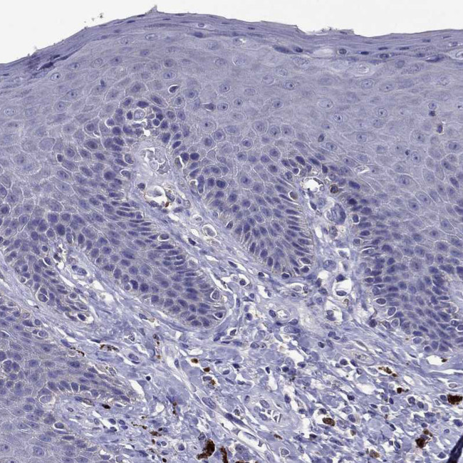 Nkx3.1 Antibody in Immunohistochemistry (Paraffin) (IHC (P))