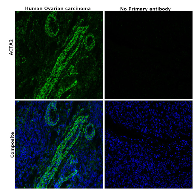 Alpha-Smooth Muscle Actin Antibody in Immunohistochemistry (Paraffin) (IHC (P))