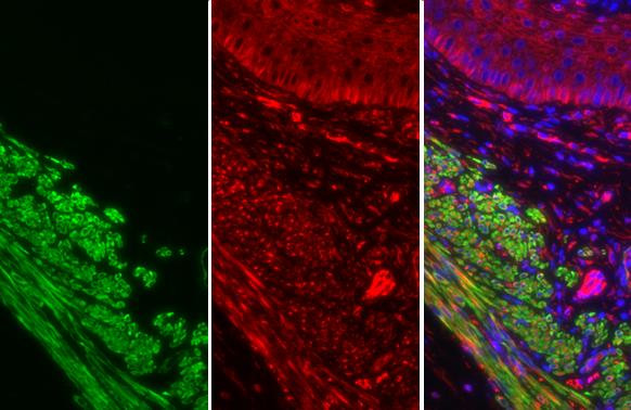 Alpha-Smooth Muscle Actin Antibody in Immunohistochemistry (Paraffin) (IHC (P))