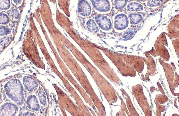 Alpha-Smooth Muscle Actin Antibody in Immunohistochemistry (Paraffin) (IHC (P))