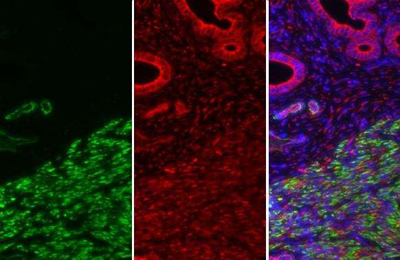 Alpha-Smooth Muscle Actin Antibody in Immunohistochemistry (Paraffin) (IHC (P))