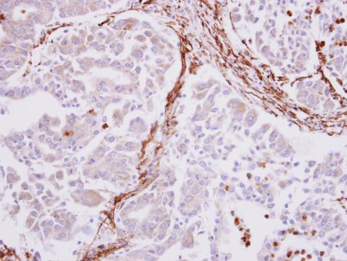 Alpha-Smooth Muscle Actin Antibody in Immunohistochemistry (Paraffin) (IHC (P))