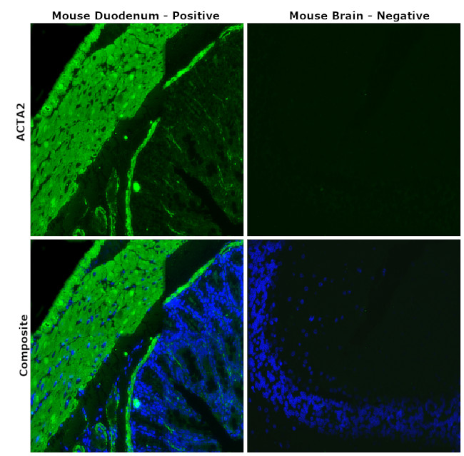 Alpha-Smooth Muscle Actin Antibody