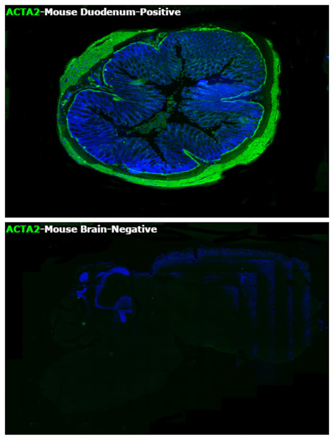 Alpha-Smooth Muscle Actin Antibody