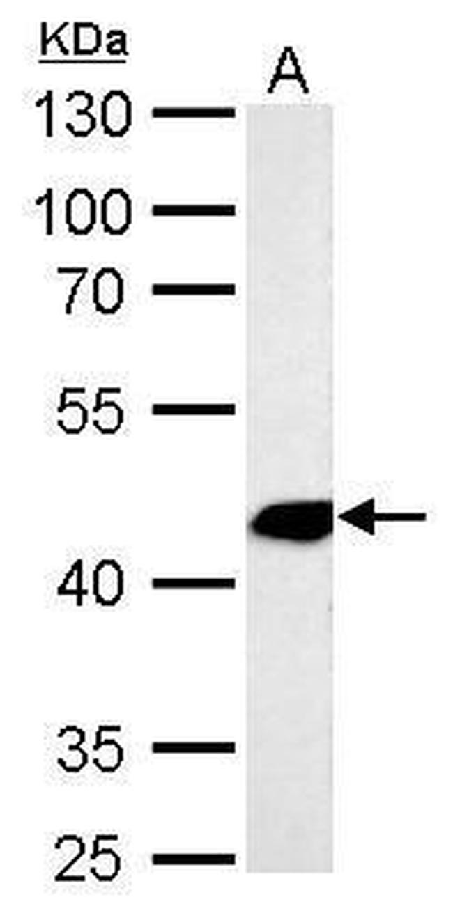 Alpha-Smooth Muscle Actin Antibody in Western Blot (WB)