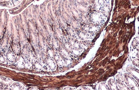 Alpha-Smooth Muscle Actin Antibody in Immunohistochemistry (Paraffin) (IHC (P))