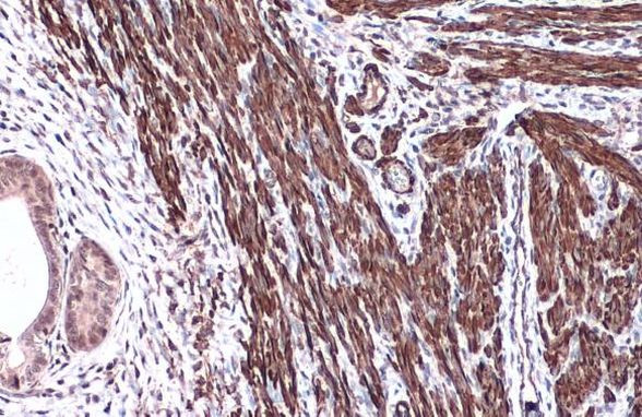 Alpha-Smooth Muscle Actin Antibody in Immunohistochemistry (Paraffin) (IHC (P))