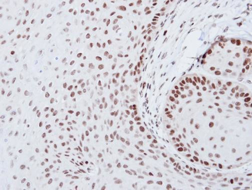 SOX2 Antibody in Immunohistochemistry (Paraffin) (IHC (P))