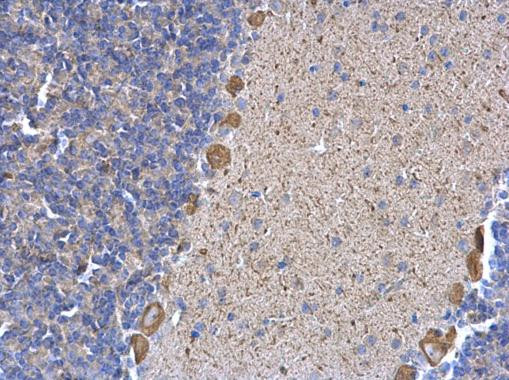 ERP29 Antibody in Immunohistochemistry (Paraffin) (IHC (P))