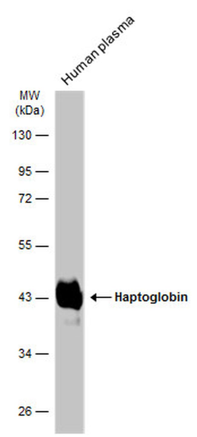 Haptoglobin Antibody in Western Blot (WB)