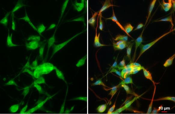 MMP2 Antibody in Immunocytochemistry (ICC/IF)